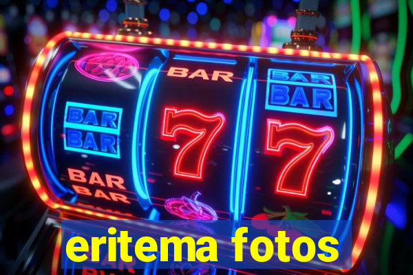 eritema fotos